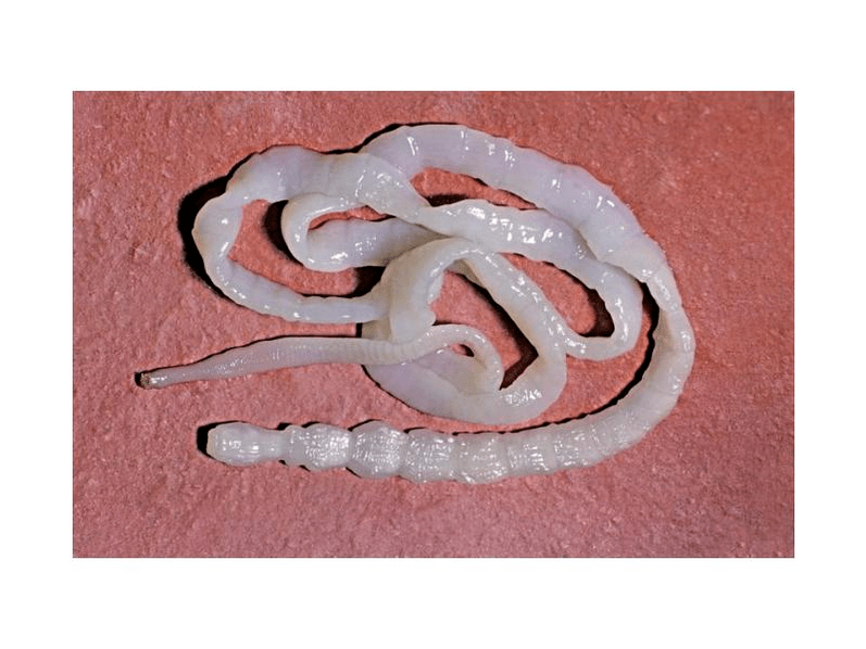 Parasites in the photo of the symptoms of the human body Toxic OFF